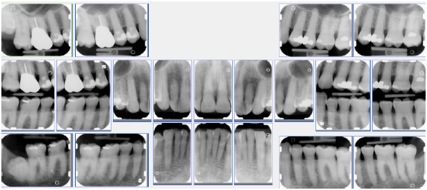 Digital Radiography